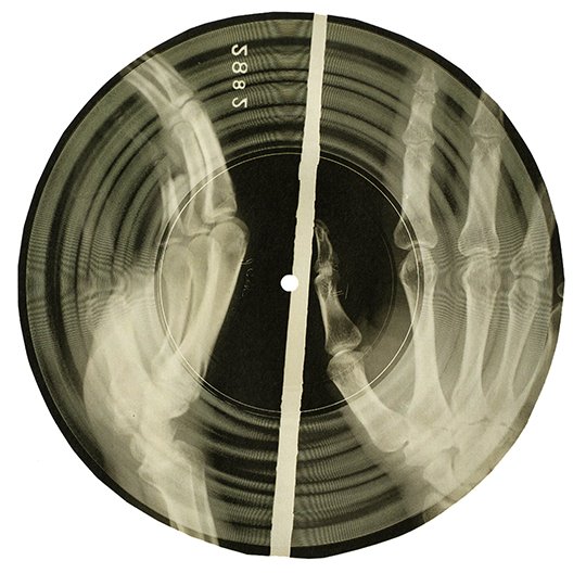 circular x-ray with handprints and record grooves