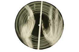 circular x-ray with handprints and grooves of record